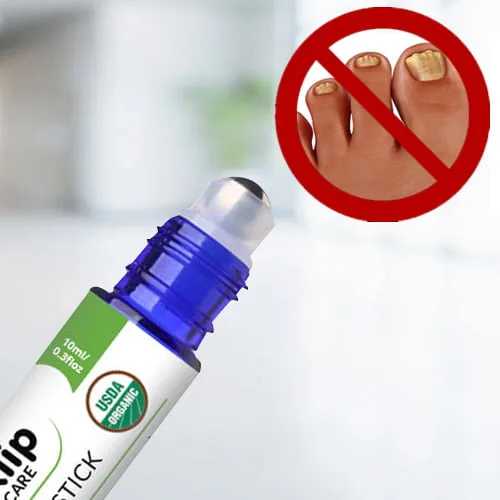 how to get rid of yellow toenails