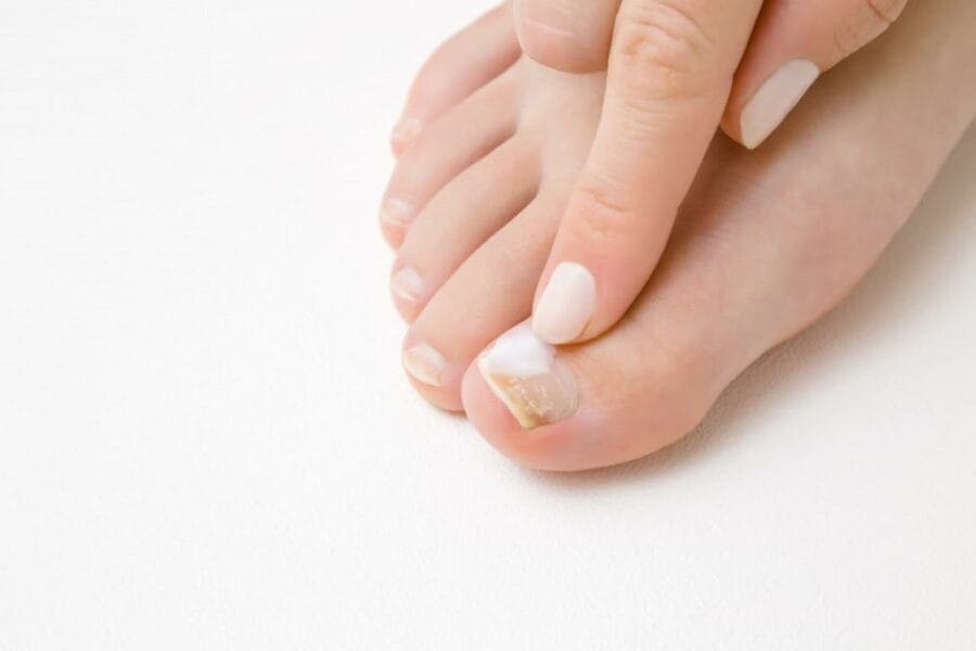 How to Cut Thick Toenails Swissklip