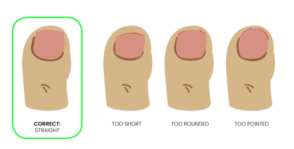 How to cut thick toenails - dont cut too short