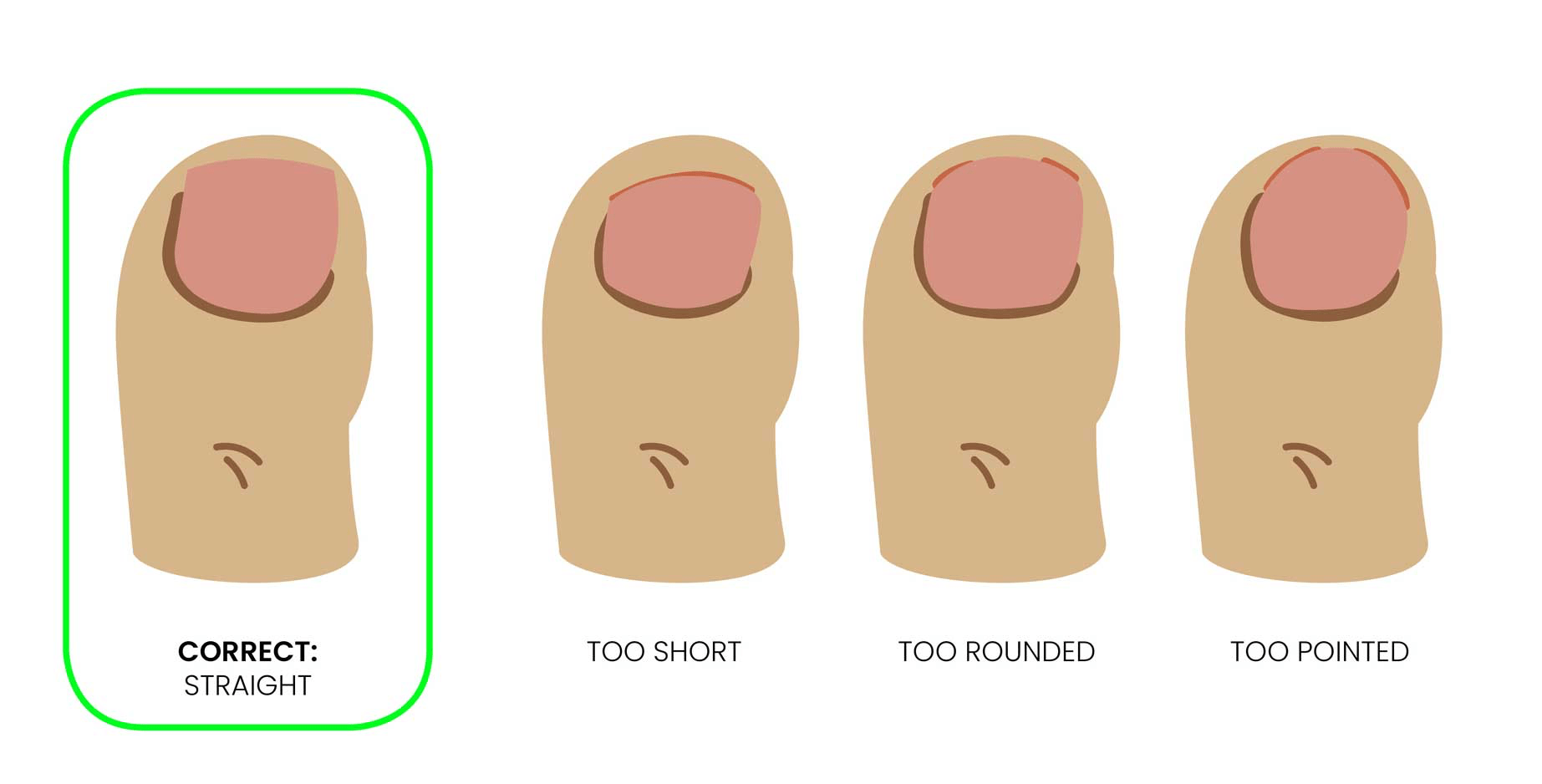 How to cut thick toenails - cut too short