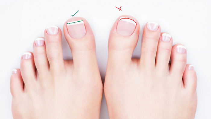 how to cut thick toenails - Cut straight across