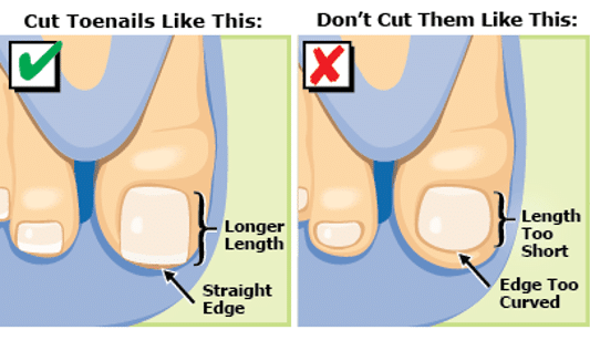 how to cut toenails for seniors