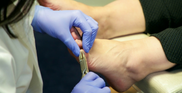 podiatrists cut toenails for seniors