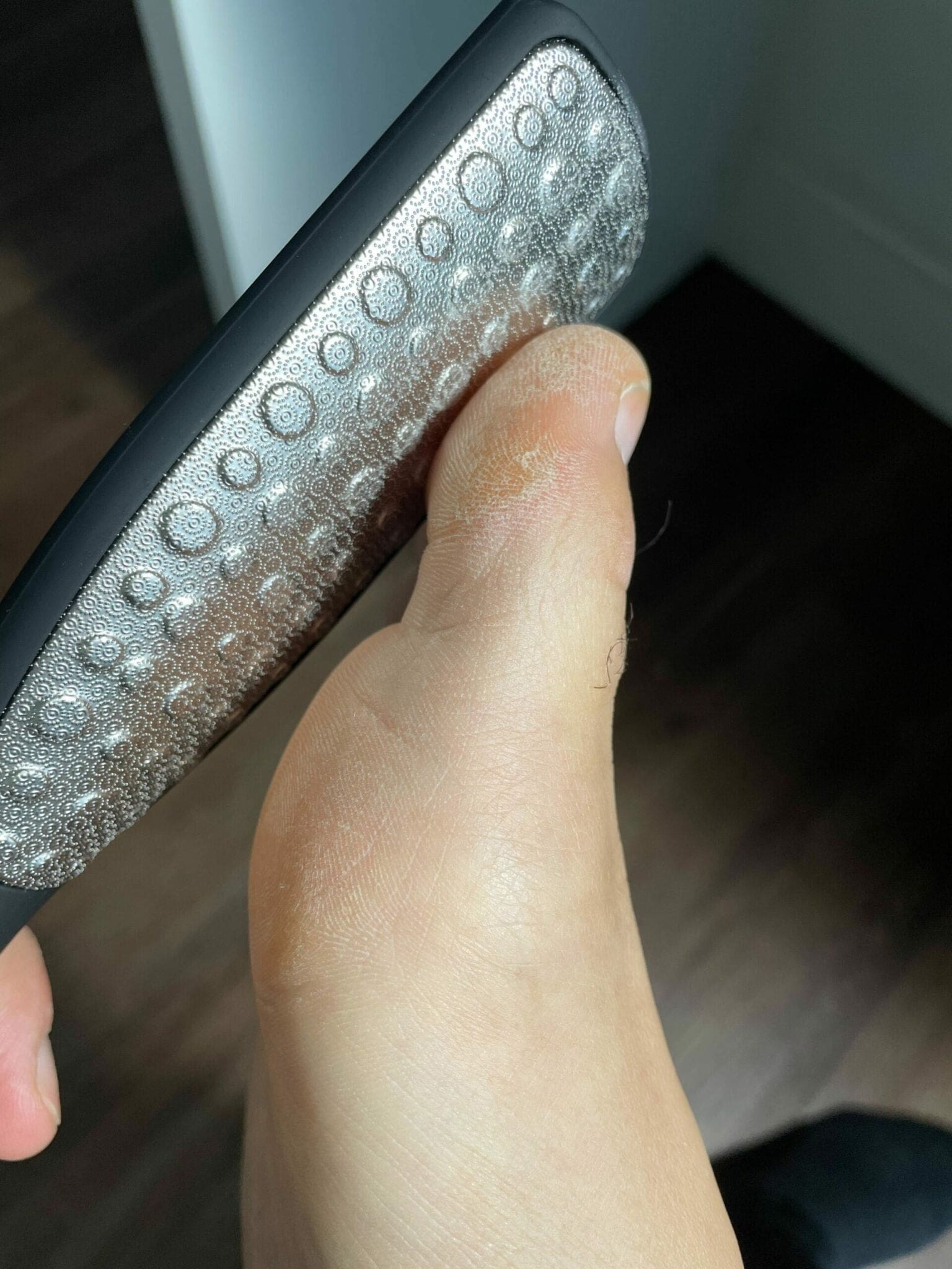How to Get Rid of Calluses On Feet - Swissklip