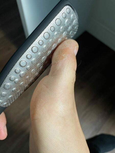 callus remover tool