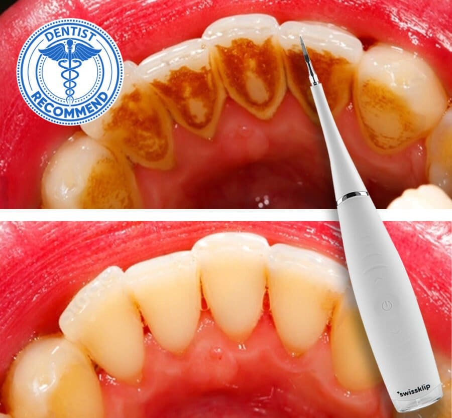 Offer PBGGCA Swissklip