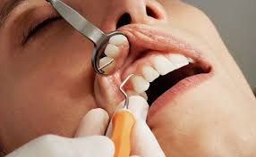 dentist check up bleeding gums when brushing your teeth