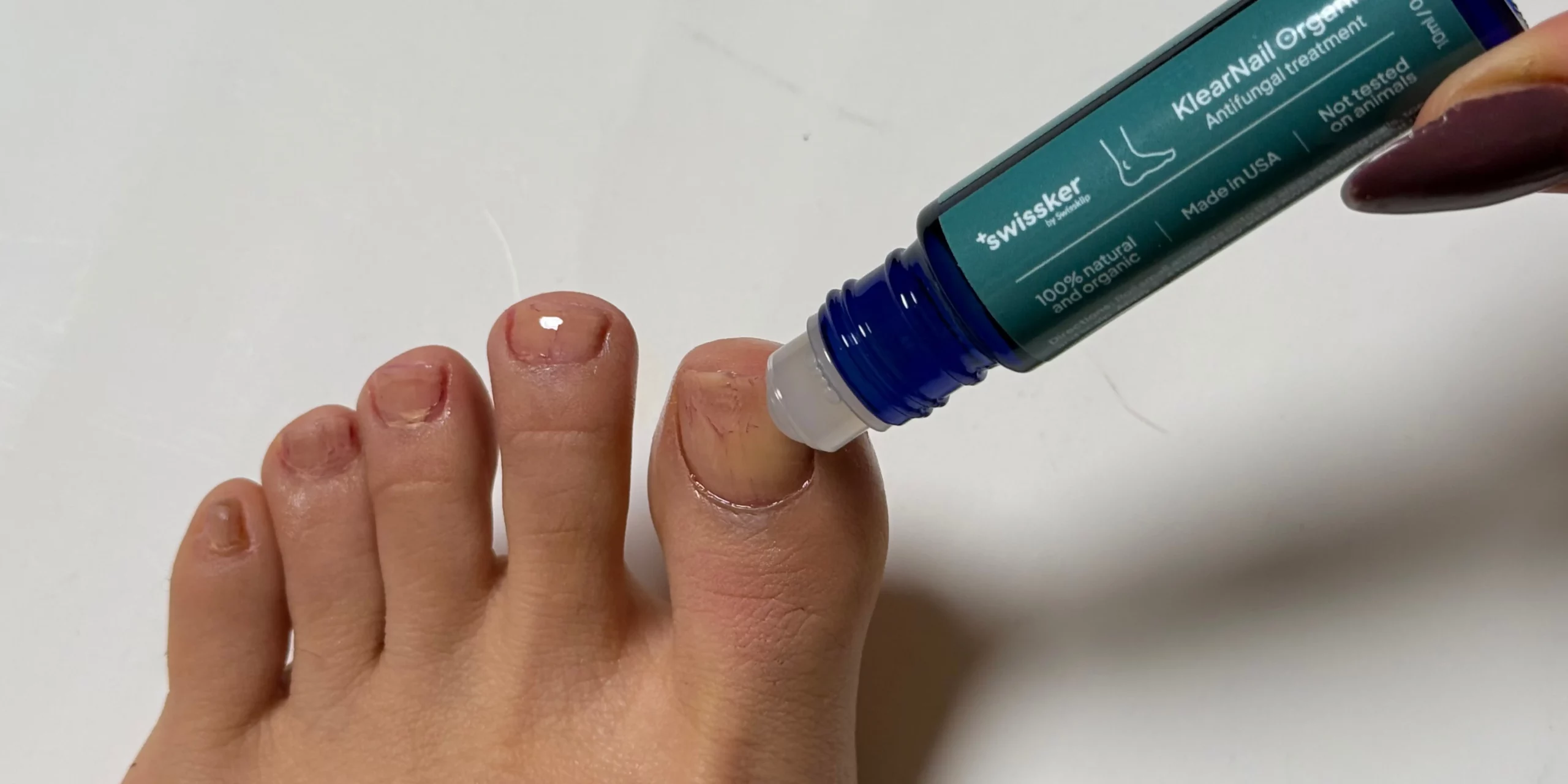 how to treat nail fungus easily