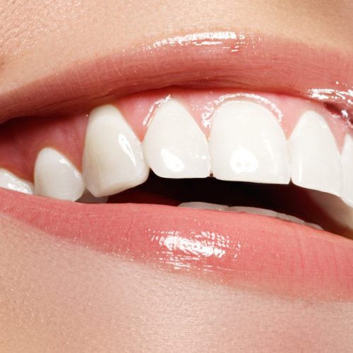 teeth whitening foam